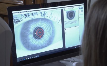 Preocupa a los oftalmólogos el crecimiento del síndrome de ojo seco en Uruguay