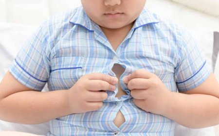 Obesidad infantil y pobreza: Una crisis silenciosa en Uruguay