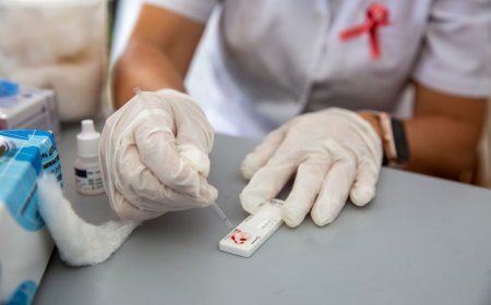 Bajan las cifras de contagios por VIH en Uruguay