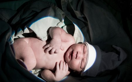 MSP trabajará para combatir las cesáreas innecesarias